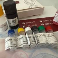 Norwalk  Viruses G1 诺如 病毒G1型探针法荧光定量RT-PCR试剂盒