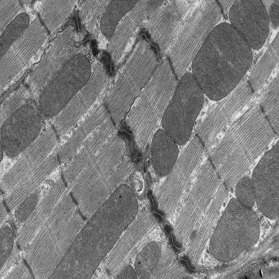 常规软组织超薄切片透射电镜（自有电镜仪器不转包）