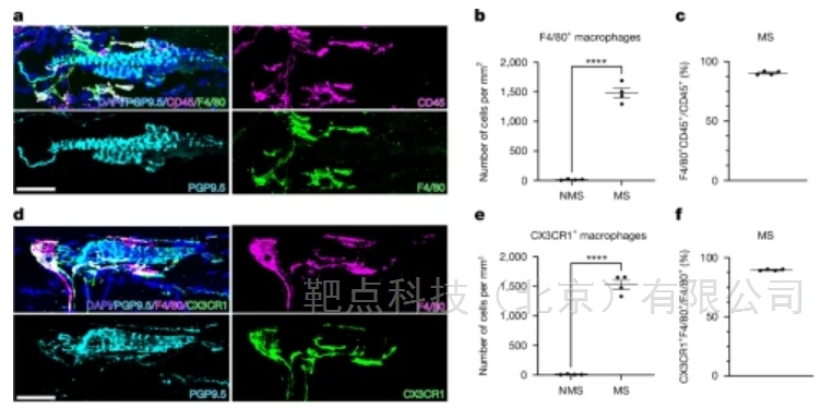 Nature：巨噬细胞是神经元细胞吗？