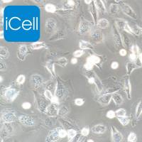 NCI-H1975细胞 | NCI-H1975细胞 | NCI-H1975细胞 | 人肺腺癌细胞 | STR鉴定 | 镜像绮点(Cellverse)