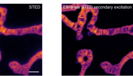Genevivo 推出新型HBmito Crimson 线粒体内膜深红色荧光染料可以用于活细胞线粒体内膜特异性荧光染色