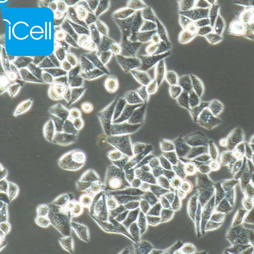 Eca-109、Eca-109细胞、Eca109细胞、Eca109、人食管癌细胞/STR鉴定/镜像绮点(Cellverse)