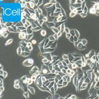 Eca-109、Eca-109细胞、Eca109细胞、Eca109、人食管癌细胞/STR鉴定/镜像绮点（Cellverse）