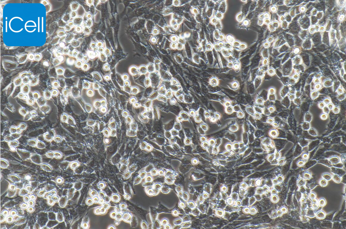 鸡气管黏膜上皮细胞永生化/鸡气管黏膜上皮细胞/气管黏膜上皮细