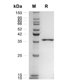 Ki67 /MKI67 蛋白, Human