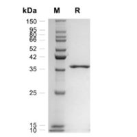 Ki67 /MKI67 蛋白, Human