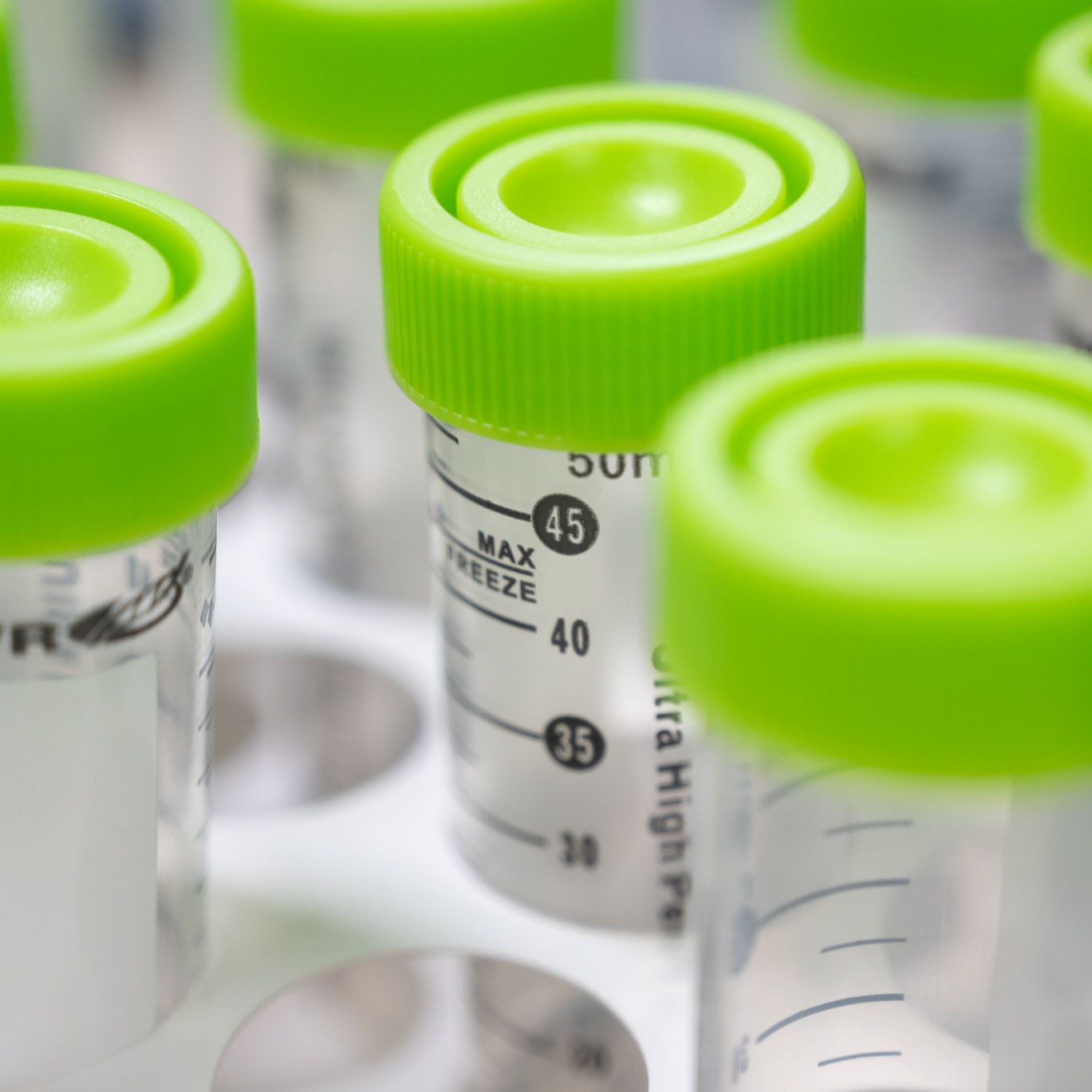 Immunoglobulin E (IgE), Normal Human Plasma