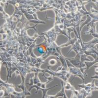 LNCaP clone FGC人前列腺癌细胞