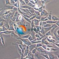 SK-N-AS人神经母细胞瘤细胞