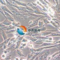 Hs683人脑视神经胶质瘤细胞
