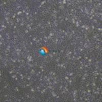 huh-7人肝癌细胞