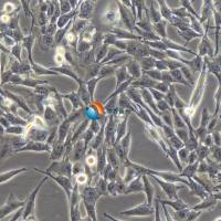M-14人黑色素瘤细胞