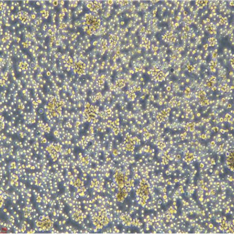 人宫颈癌细胞HELA/RFP (带红色荧光)