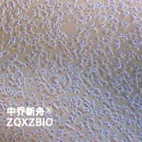 HCCLM3人肝癌细胞（高转）