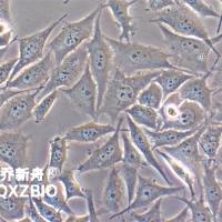 PC-3M人前列腺癌细胞