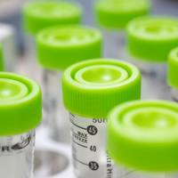 Immunoglobulin M, IgM mu链, Human Plasma