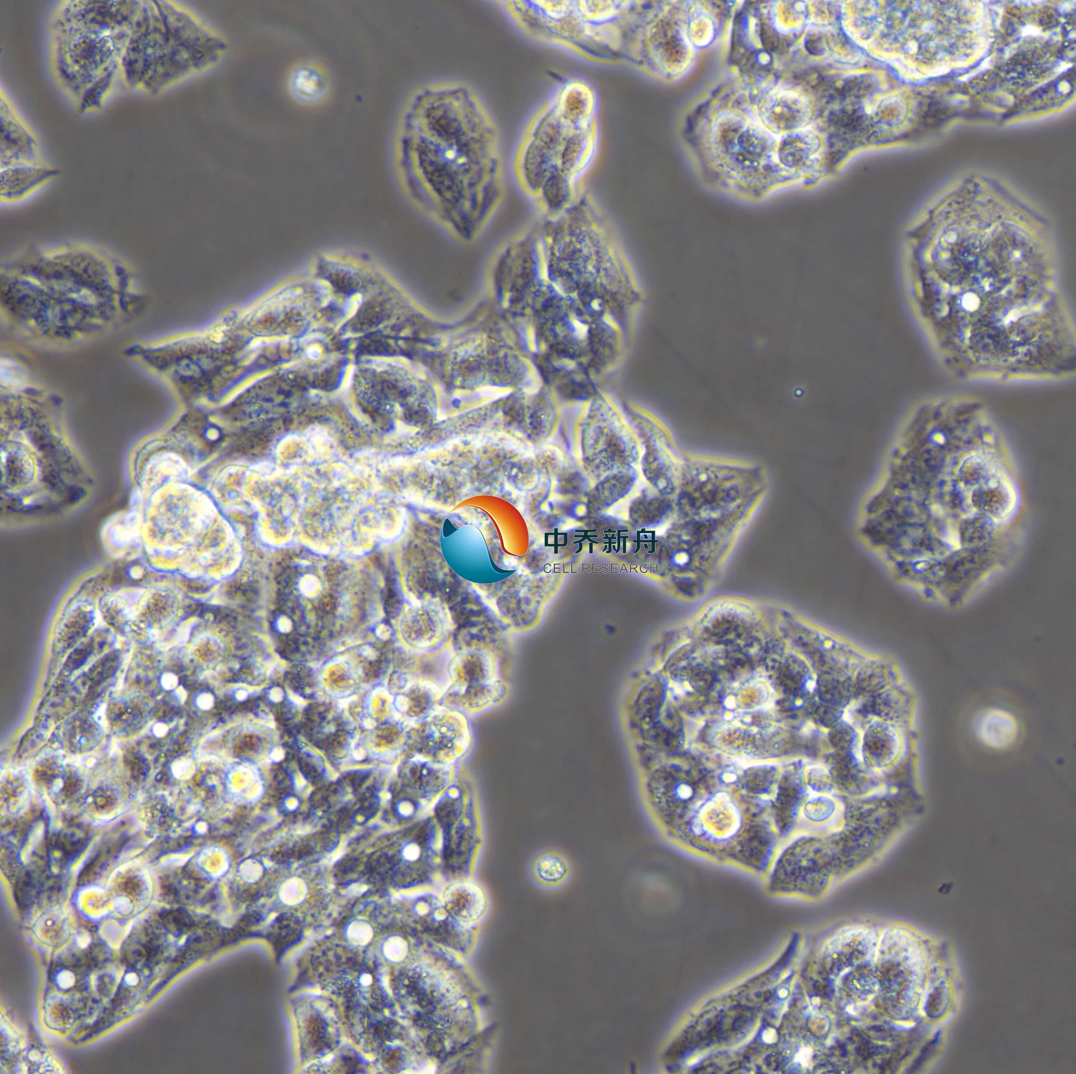 Hep G2人肝癌细胞