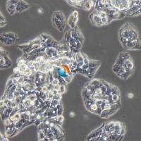 Hep G2人肝癌细胞