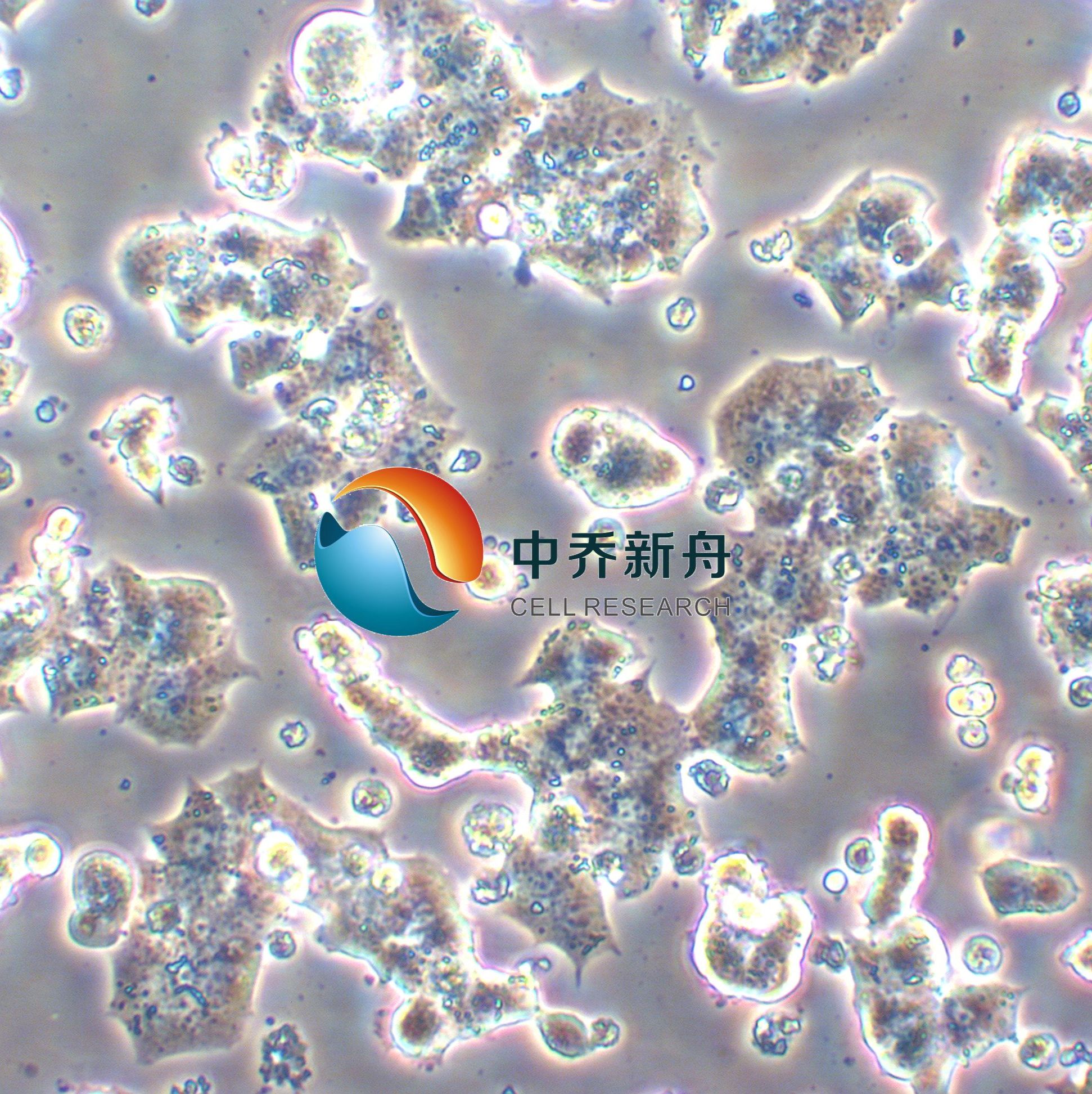Beta-TC-6小鼠胰岛素瘤胰岛β细胞