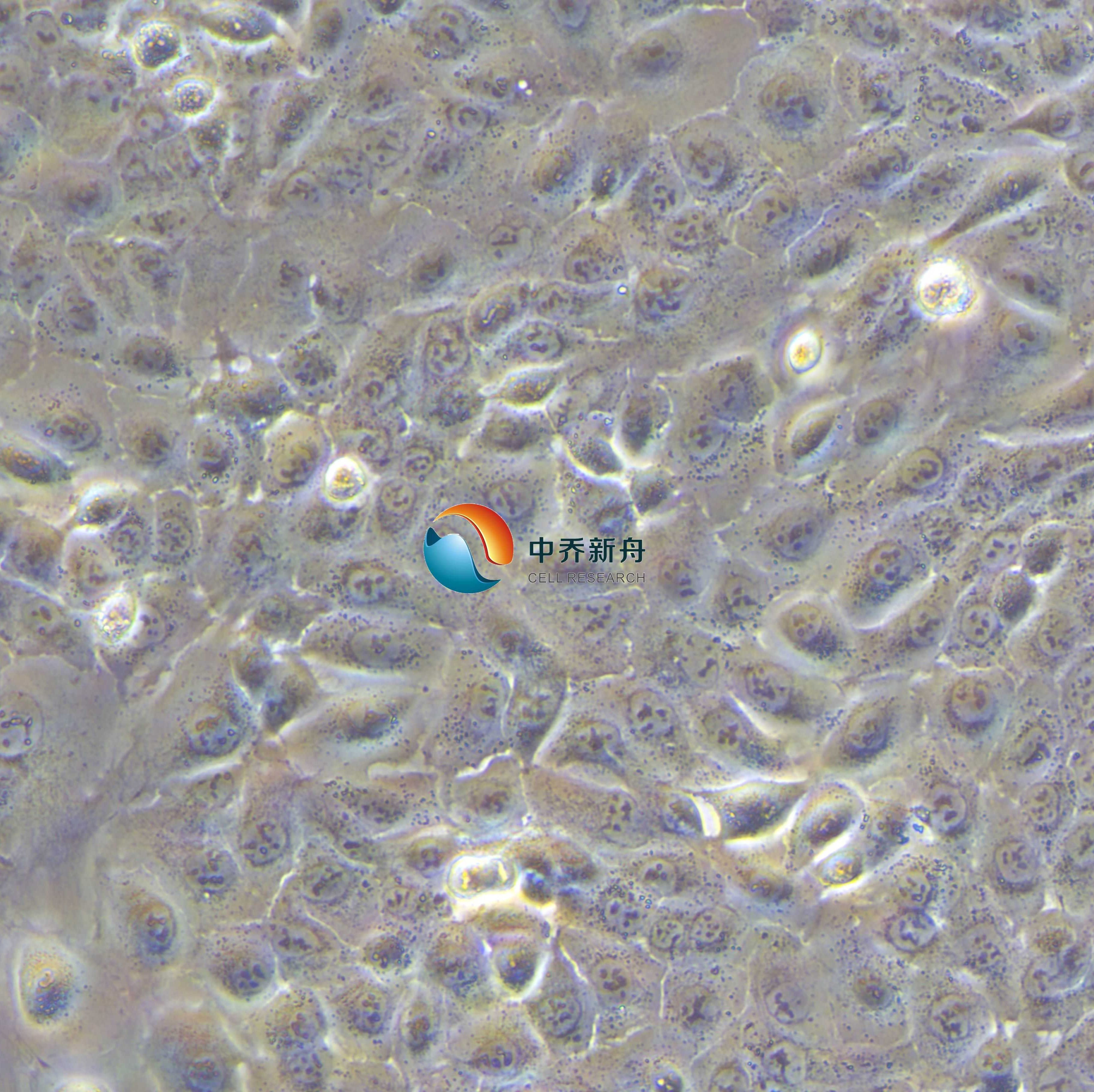 DU 145人前列腺癌细胞