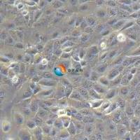 DU 145人前列腺癌细胞