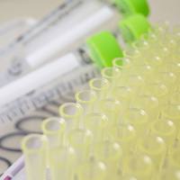 IgA1, Immunoglobulin A1, Human Myeloma Plasma