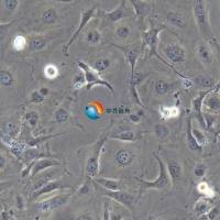 LX-2人肝星形细胞