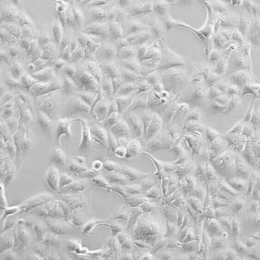 小鼠纤维肉瘤细胞MCA205/RFP (带红色荧光)
