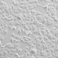 鲤鱼上皮细胞/胖头鲦鱼上皮细胞EPC/RFP  (带红色荧光)