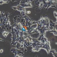 22RV1人前列腺癌细胞