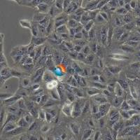 A375人恶性黑色素瘤细胞