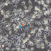 PC-3人前列腺癌细胞