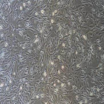 人舌头鳞癌细胞UPCISCC090/RFP (带红色荧光)