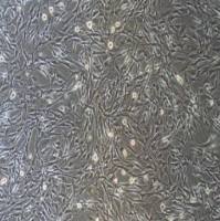 Walker氏癌肉瘤256瘤株W256/RFP  (带红色荧光)