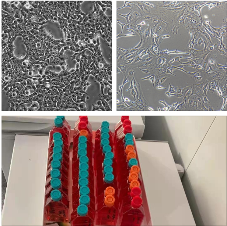 大鼠卵巢癌细胞Nutu19/RFP (带红色荧光)
