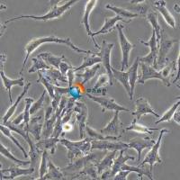 U-87 MG人脑星形胶质母细胞瘤