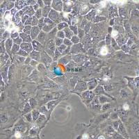 Caco-2人结肠腺癌细胞（STR鉴定）