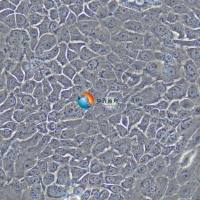 BxPC-3人原位胰腺腺癌细胞