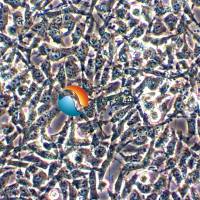 ES-2人卵巢透明细胞癌细胞