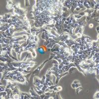 LOVO人结肠癌细胞