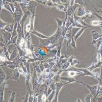 NOR-10小鼠骨骼肌成纤维细胞