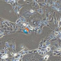 OV-90人卵巢癌细胞