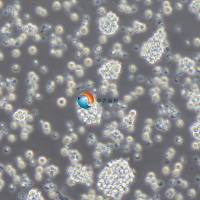 Jurkat,Clone E6-1人T淋巴细胞白血病细胞