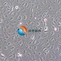 Ca Ski人宫颈癌肠转移细胞