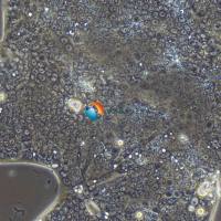 NCI-N87人胃癌细胞