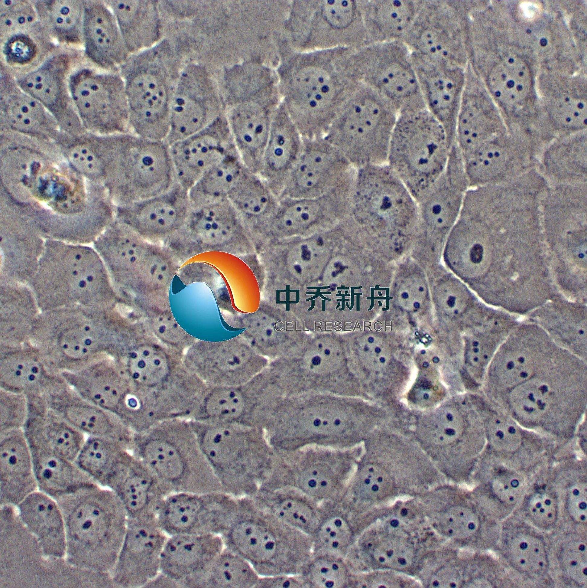HT-3人子宫颈癌细胞