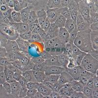 HT-3人子宫颈癌细胞