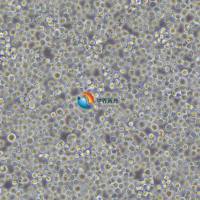 Raji人Burkitts淋巴瘤细胞