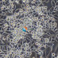 SK-BR-3人乳腺癌细胞