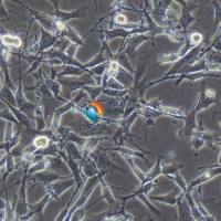 TM4小鼠睾丸支持细胞